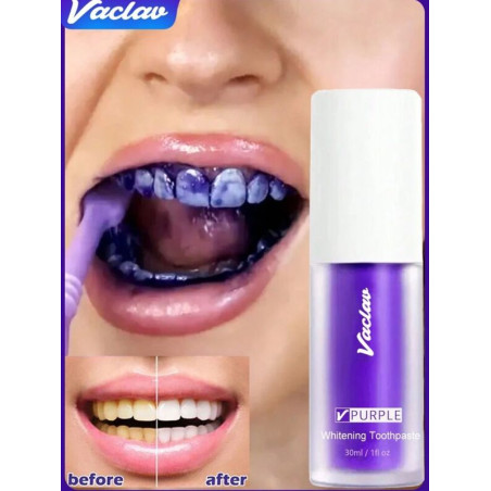 Toothpaste Vaclav